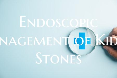 Endoscopic Management of Kidney Stones