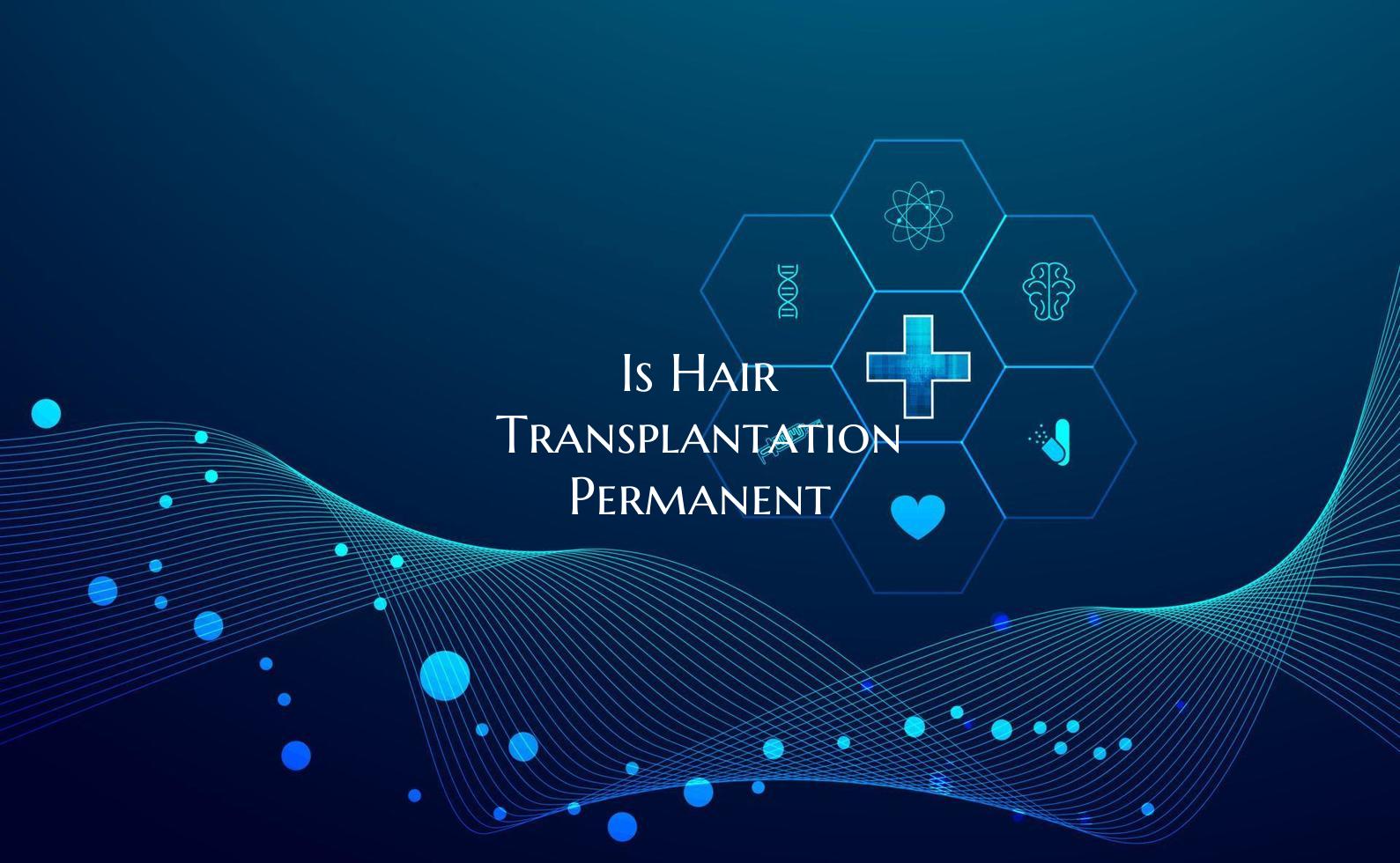 Is Hair Transplantation Permanent