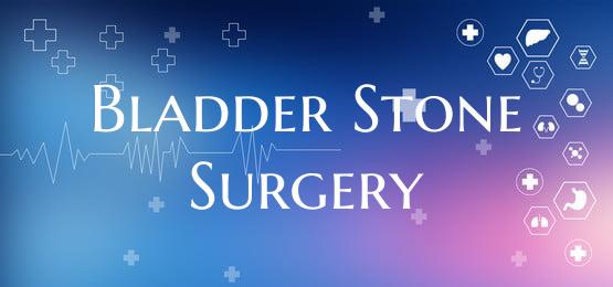 Bladder Stone Surgery