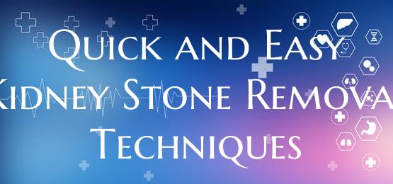 Quick and Easy Kidney Stone Removal Techniques