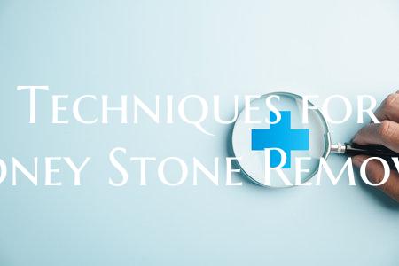 Techniques for Kidney Stone Removal